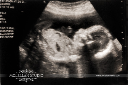 ultrasoundphotoweb.jpg